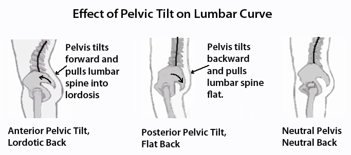 Anterior pelvic outlet tilt sitting posture