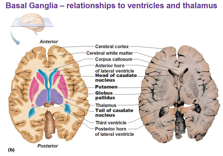 Cerebral White Matter and Gray Matter and Basal Ganglia - Antranik.org