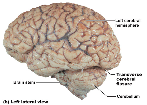 cerebral hemispheres